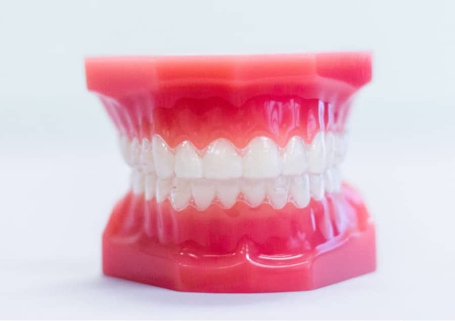 clear invisalign aligners on plastic model