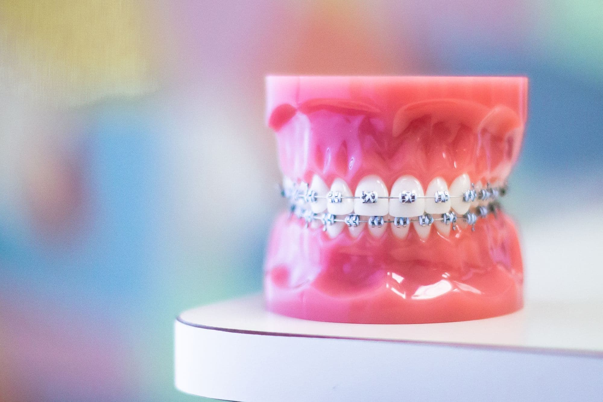 metal braces on plastic mouth model
