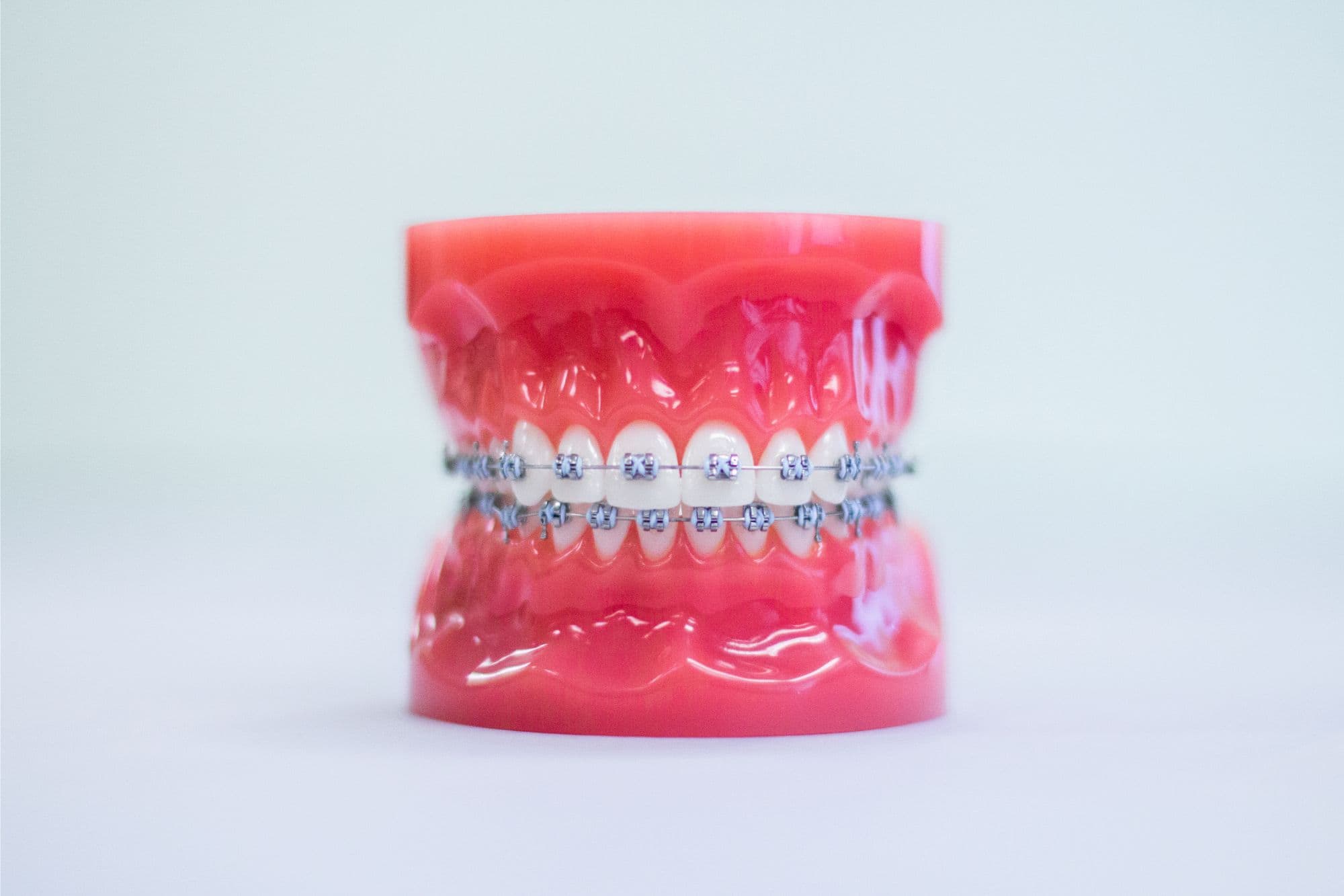 Braces vs. Invisalign: Choosing the Right Treatment