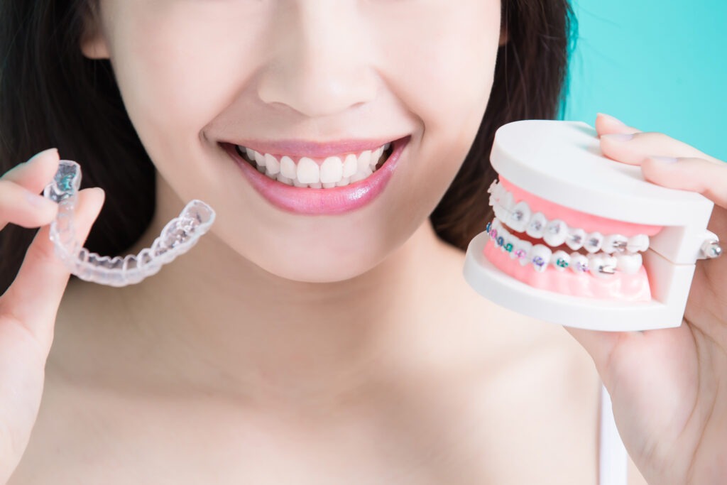 Braces vs. Invisalign: Choosing the Right Treatment