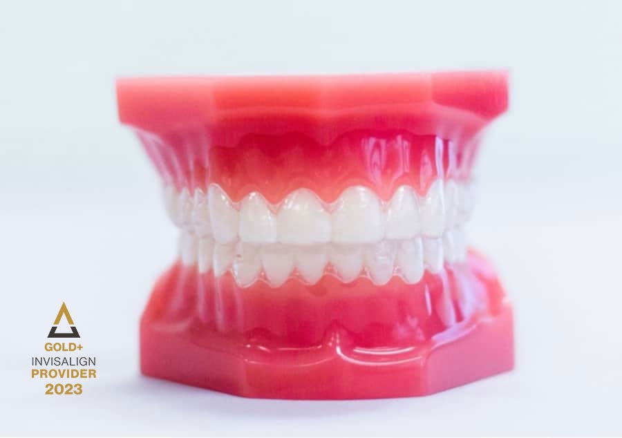 clear invisalign aligners on plastic model